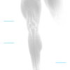 LEG02CZONA4